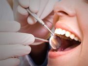 Servicii stomatologice gratuite pentru români în 2024: ce acoperă Casa de Asigurări