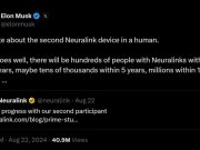 Elon Musk prevede un viitor în care milioane de oameni vor avea implanturi cerebrale Neuralink în următorul deceniu