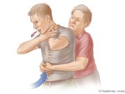 Proceduri de Prim Ajutor în cazul înecului cu mâncare și al infarctului – Cunoștințe salvatoare pentru fiecare