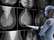 Inteligența artificială revoluționează depistarea cancerului la sân: cu 29% mai multe cazuri identificate față de metodele tradiționale