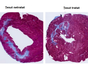 Un nou tratament injectabil promite să protejeze inima după un infarct